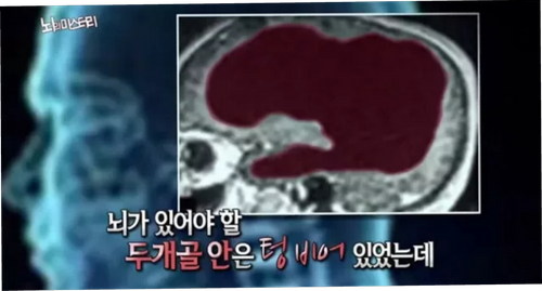 미라클PC방 이미지