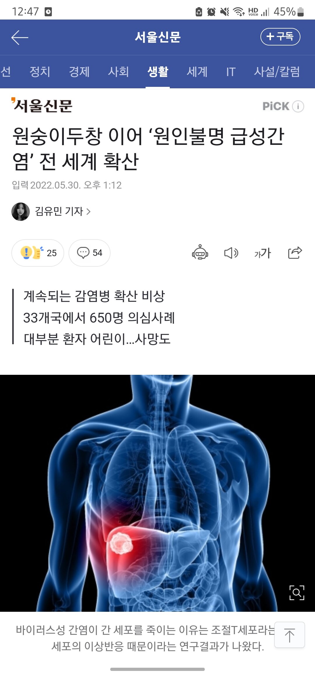 원숭이두창 이어 ‘원인불명 급성간염’ 전 세계 확산 - 오픈이슈갤러리 - 인벤