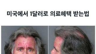 미국에서 1달러로 치료 받기