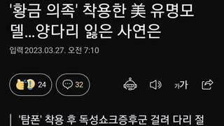 '황금 의족' 착용한 美 유명모델…양다리 잃은 사연은