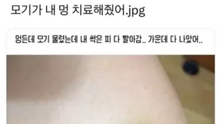 모기가 내 멍 치료해줬어.jpg