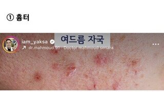 약사가 추천하는 상황별 피부 연고ㄷㄷ