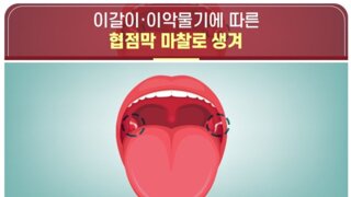 '혀로 볼 안쪽을 할짝여보세요'