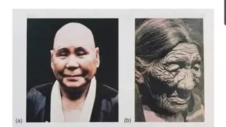 자외선의 위험성