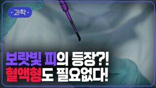 혈액형 상관없는 보라색 피