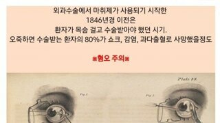 약혐)근대 외과 수술 교육용 기록 사진