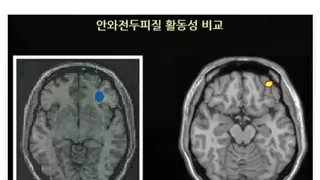 인터넷 중독 5년 이상이면 뇌 회복은 불가능하다