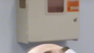 머리에 혹이 있는 남자.