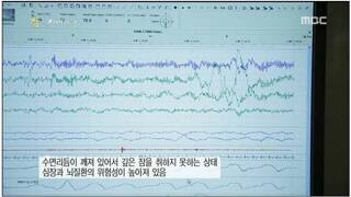 수면이 부족할때 일어나는 현상