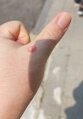 썸네일 이미지