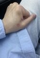 썸네일 이미지