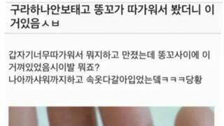 똥꼬 따가워서 봤더니 이거 있음