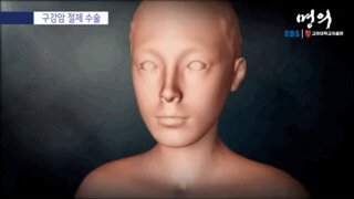 구강암 절제 수술 과정