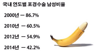 포경 수술 통계