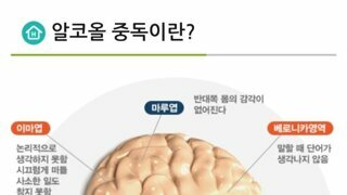 알콜이 뇌에 미치는 영향