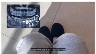의사말을 듣지않은 최후