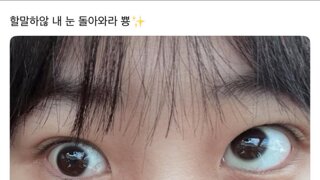 현재 스레드 난리난 눈밑지방수술 부작용