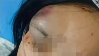 중국, ‘학폭’ 처분 항의했더니 가축용 트럭에 태워 연행